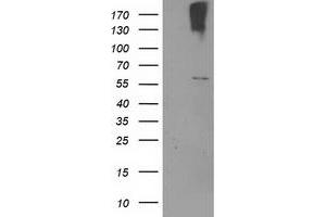 Western Blotting (WB) image for anti-Cytochrome P450, Family 2, Subfamily J, Polypeptide 2 (CYP2J2) antibody (ABIN1497734) (CYP2J2 anticorps)