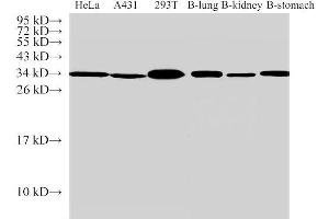Western Blot analysis of 1)Hela, 2)A431, 3)293T, 4)Bovine lung, 5)Bovine kidney, 6)Bovine stomach using ANXA5 Polyclonal Antibody at dilution of 1:500 (Annexin V anticorps)
