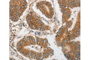 Immunohistochemistry (IHC) image for anti-Progesterone Immunomodulatory Binding Factor 1 (PIBF1) antibody (ABIN3023472) (PIBF1 anticorps)