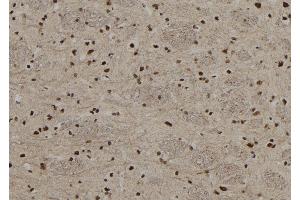 ABIN6255514 and ABIN6267208 at 1/100 staining Rat brain tissue by IHC-P. (MECP2 anticorps  (pSer80))