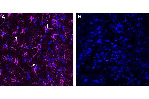 Expression of GFAP in rat hippocampus. (GFAP anticorps  (Intracellular) (Atto 647N))