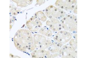 Immunohistochemistry of paraffin-embedded Human stomach using DNAL1 Polyclonal Antibody at dilution of 1:100 (40x lens). (DNAL1 anticorps)