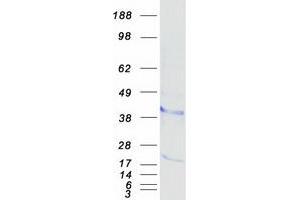 Validation with Western Blot