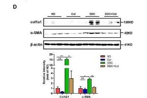 Calcipotriol alleviates DDC-induced liver injury and fibrosis. (COL1A1 anticorps  (AA 100-200))