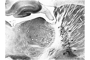 Adult rat striatum immunohistochemistry.