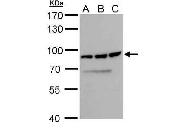 DDX18 Antikörper  (Center)