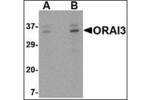 Western blot analysis of ORAI3 in A20 cell lysate with this product at (A) 2 and (B) 4 μg/ml. (ORAI3 anticorps  (C-Term))