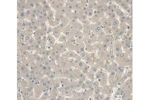 IHC-P analysis of Human Liver Tissue, with DAB staining. (IGFBP2 anticorps  (AA 148-325))