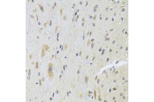 Immunohistochemistry of paraffin-embedded rat spinal cord using DPP3 Antibody (ABIN5975468) at dilution of 1/100 (40x lens). (DPP3 anticorps)
