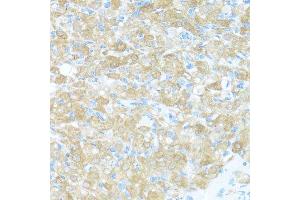 Immunohistochemistry of paraffin-embedded rat ovary using FGFR2 antibody.
