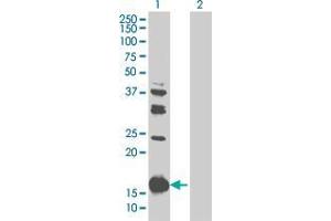Lane 1: PYCARD transfected lysate ( 16. (ASC 293T Cell Transient Overexpression Lysate(Denatured))
