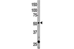The Beclin 1 antibody used in western blot to detect BECN1 in mouse liver tissue lysate (Beclin 1 anticorps  (AA 181-210))