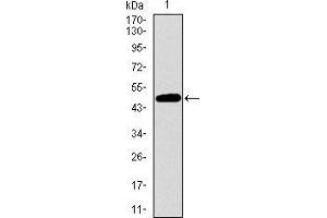 Western blot analysis using TP53BP1 mAb against human TP53BP1 recombinant protein.