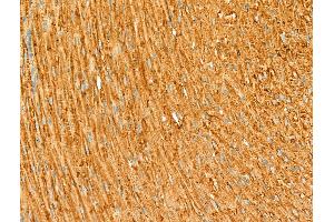 ABIN6264198 and ABIN6266655 at 1/100 staining Rat heart tissue by IHC-P. (PIAS3 anticorps  (N-Term))