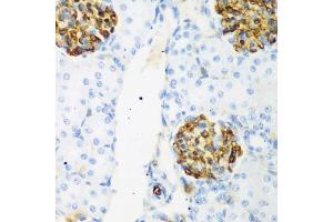 Immunohistochemistry of paraffin-embedded rat kidney using CSRNP1 antibody (ABIN5974288) at dilution of 1/200 (40x lens). (AXUD1 anticorps)
