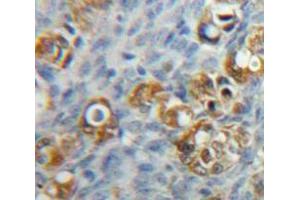 Used in DAB staining on fromalin fixed paraffin-embedded Ovary tissue (F11R anticorps  (AA 64-249))