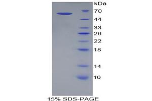SDS-PAGE analysis of Human KIR2DL3 Protein. (KIR2DL3 Protéine)