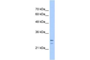 Western Blotting (WB) image for anti-Signal Recognition Particle Receptor, B Subunit (SRPRB) antibody (ABIN2463283) (SRPRB anticorps)