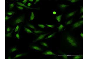 Immunofluorescence of monoclonal antibody to PRKCD on HeLa cell. (PKC delta anticorps  (AA 577-676))