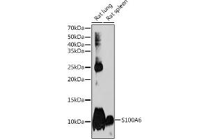 Western blot analysis of extracts of various cell lines, using S100 Rabbit mAb (ABIN7270127) at 1:1000 dilution. (S100A6 anticorps)