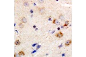 Immunohistochemical analysis of PKC theta staining in human brain formalin fixed paraffin embedded tissue section. (PKC theta anticorps  (C-Term))