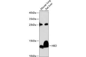 Western blot analysis of extracts of various cell lines, using HBD antibody (ABIN6132879, ABIN6141642, ABIN6141643 and ABIN6224938) at 1:3000 dilution. (HBd anticorps  (AA 1-147))