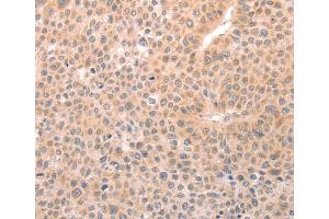 Immunohistochemistry (IHC) image for anti-Transient Receptor Potential Cation Channel, Subfamily C, Member 3 (TRPC3) antibody (ABIN2426987) (TRPC3 anticorps)