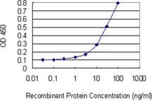 Detection limit for recombinant GST tagged GEMIN4 is 1 ng/ml as a capture antibody.
