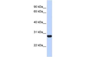 Western Blotting (WB) image for anti-Ribosomal Protein L13 (RPL13) antibody (ABIN2462055) (RPL13 anticorps)