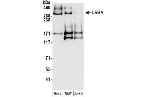 Western Blotting (WB) image for anti-LPS-Responsive Vesicle Trafficking, Beach and Anchor Containing (LRBA) (AA 1125-1175) antibody (ABIN7453123)