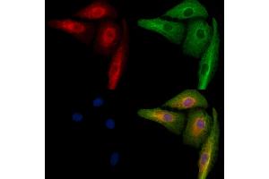 ABIN6259719 and ABIN6279066 staining  cells by IF/ICC.