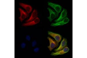ABIN6262730 and ABIN6266734 staining Hela cells by IF/ICC. (Adenylate Kinase 1 anticorps  (Internal Region))