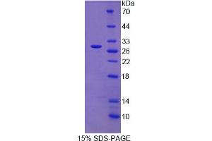 Image no. 1 for Sorting Nexin 13 (SNX13) (AA 97-284) protein (His tag) (ABIN6236841) (SNX13 Protein (AA 97-284) (His tag))