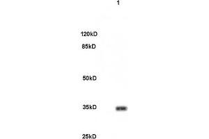 Mouse brain lysates 30ug, probed (ABIN679988) at 1:200 overnight in 4 °C.