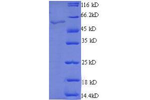 StAR-Related Lipid Transfer (START) Domain Containing 7 (STARD7) (AA 61-307), (partial) protein (GST tag)