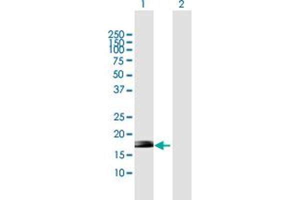 ZNF576 antibody  (AA 1-170)