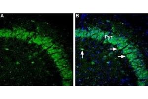 Expression of GABRA5 in mouse brain - Immunohistochemical staining of mouse hippocampus sections using Anti-GABA(A) α5 Receptor Antibody (ABIN7043189, ABIN7044317 and ABIN7044318), (1,600).