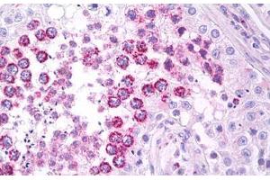 Anti-EI24 / PIG8 antibody IHC staining of human testis. (EI24 anticorps  (C-Term))