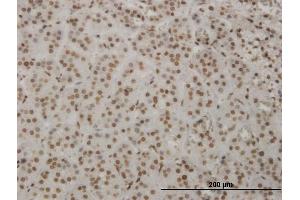 Immunoperoxidase of monoclonal antibody to HMX2 on formalin-fixed paraffin-embedded human adrenal gland.