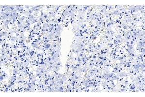 ABIN5855385 Negative Control showing staining of paraffin embedded Human Lung, with no primary antibody.