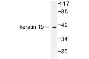 Image no. 1 for anti-Keratin 19 (KRT19) antibody (ABIN265499) (Cytokeratin 19 anticorps)