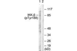 Western blot analysis of extracts from COS7 cells, using IKK-beta (Phospho-Tyr188) Antibody. (IKBKB anticorps  (pTyr188))