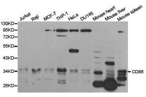 Western Blotting (WB) image for anti-CD86 (CD86) antibody (ABIN1871657) (CD86 anticorps)