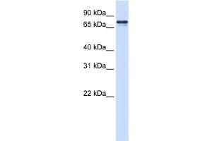 WB Suggested Anti-SRP68 Antibody Titration:  0. (SRP68 anticorps  (N-Term))