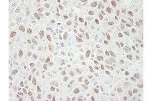 Immunohistochemistry (IHC) image for anti-Minichromosome Maintenance Deficient 4 (MCM4) (AA 750-800) antibody (ABIN7448654) (MCM4 anticorps  (AA 750-800))