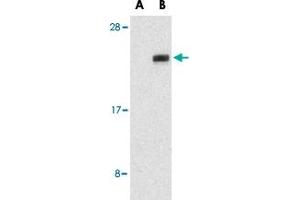 Western blot analysis of NGFRAP1 in human brain tissue lysates with NGFRAP1 polyclonal antibody  at 1 ug/mL in the presence (A) or absence (B) of blocking peptide. (Nerve Growth Factor Receptor (TNFRSF16) Associated Protein 1 (NGFRAP1) (Internal Region) anticorps)