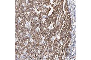Immunohistochemical staining of human tonsil with NCAPH polyclonal antibody  shows cytoplasmic positivity in reaction center cells. (NCAPH anticorps)