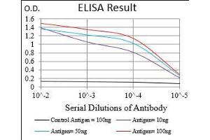 Black line: Control Antigen (100 ng), Purple line: Antigen(10 ng), Blue line: Antigen (50 ng), Red line: Antigen (100 ng), (CD36 anticorps  (AA 30-130))