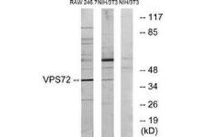Western Blotting (WB) image for anti-Vacuolar Protein Sorting 72 Homolog (S. Cerevisiae) (VPS72) (AA 131-180) antibody (ABIN2879153) (VPS72 anticorps  (AA 131-180))