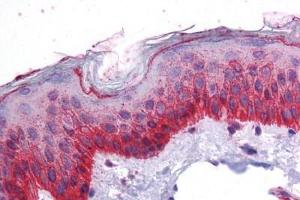 Human Skin: Formalin-Fixed, Paraffin-Embedded (FFPE) (BMP7 anticorps  (AA 165-214))